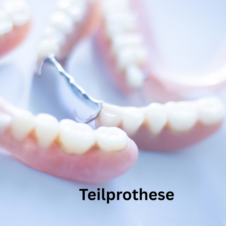 Teilprothese beim Zahnarzt Regensburg