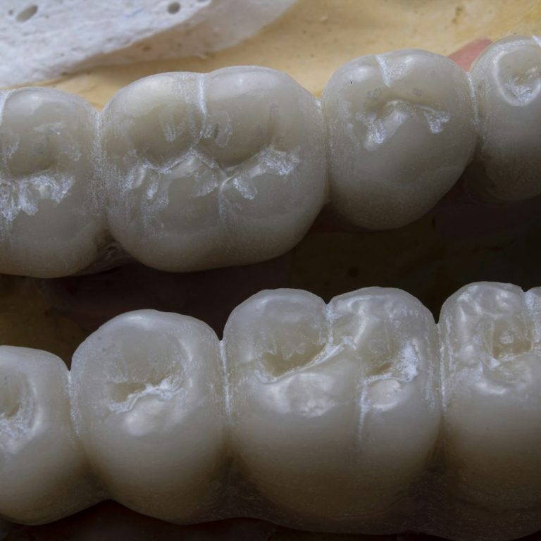 Zahnersatz Regensburg