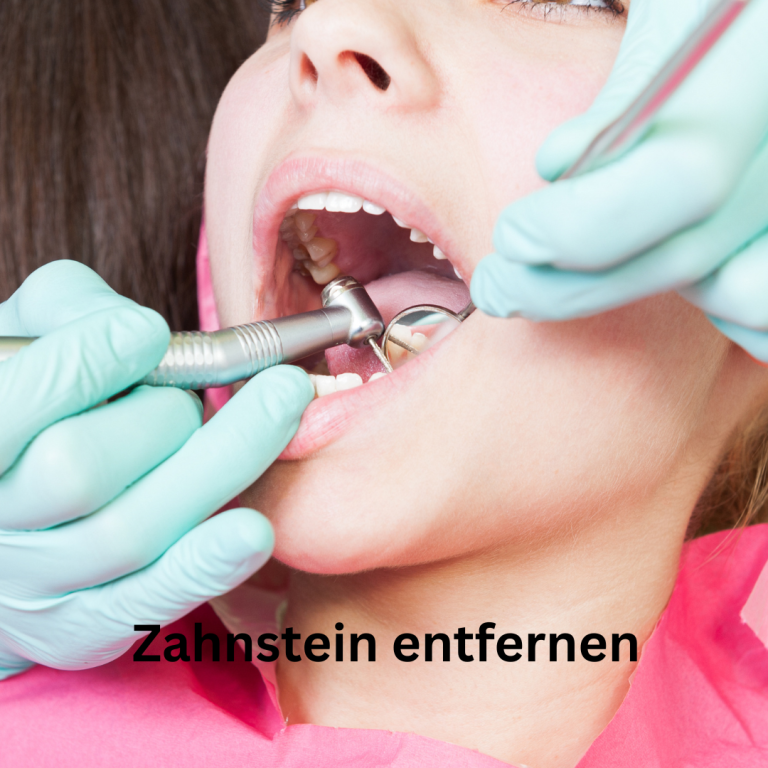 Zahnstein entfernen Zahnarztpraxis Regensburg