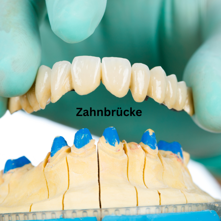 Zahnbrücke Regensburg